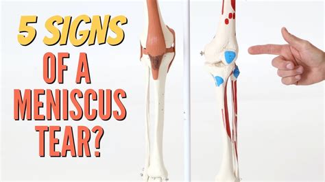 what does meniscus pain feel like